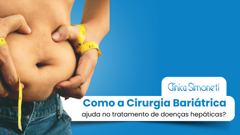 Cirurgiões realizando cirurgia bariátrica em uma sala de operação com modelo de fígado em destaque.